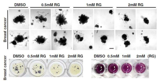 신규물질 RG 처리 시 유방암 환자 유래 오거노이드 특이적 세포사멸