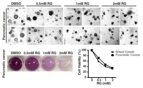 신규물질 RG 처리 시 췌장암 환자 유래 오거노이드 특이적 세포사멸