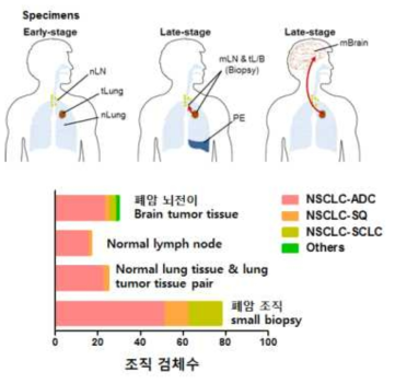 폐암 연구 코호트 개요 및 샘플 현황