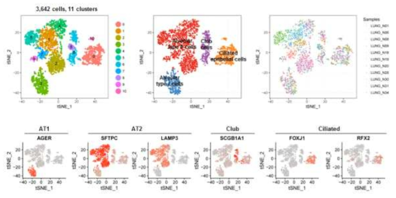 정삼 폐조직 유래 Epithelial cell의 subset