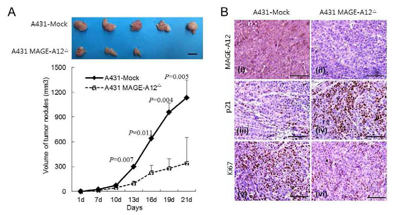 MAGE-A12가 피부편평세포암 종양형성 및 p21발현에 미치는 영향