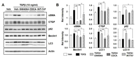 FXR ligands regulates autophagy protein in HK2 cells. (A) HK2 cells were treated with FXR ligands, GW4064, CDCA, and INT-747, for 1h, and then treaed with TGFβ (10 ng/ml) for 24h. Protein levels of αSMA, CTGF, p62, Beclin1, LC3, and Actin were detected by immunoblot. (B) Each protein/Actin levels in the vehicle-treated sample were set as 1. Relative levels are shown (n=3)