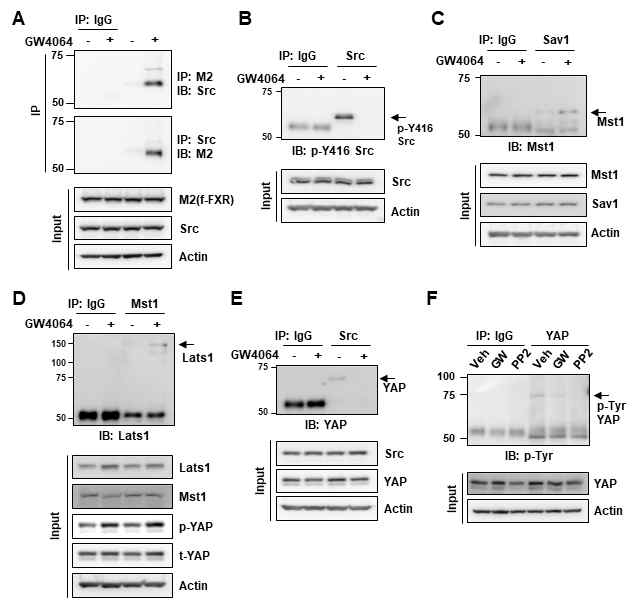 FXR agonist GW4064 treatment activates Hippo pathway. (A) HK2 cells were transfected with flag-FXR expression plasmid, and then, the cells were treated with 200 nM GW4064 for 30 min. Flag-FXR interaction with Src was detected by co-immunoprecipitation/immunoblot. (B-E) Cells were treated with GW4064 (200 nM) for 30 min, and p-Src levels were determined by immunoprecipitation/immunoblot (B). Mst1 interaction with Sav1 (C) or Lats1 (D) was detected by co-immunoprecipitation. (E) Src interaction with YAP was detected by co-immunoprecipitation. (F) Cells were treated with vehicle, GW4064 (GW, 200 nM), or PP2 (5 μM) for 30 min, and then, p-Tyr-YAP was detected by immunoprecipitation/immunoblot. Protein levels in input samples were detected by immunoblot