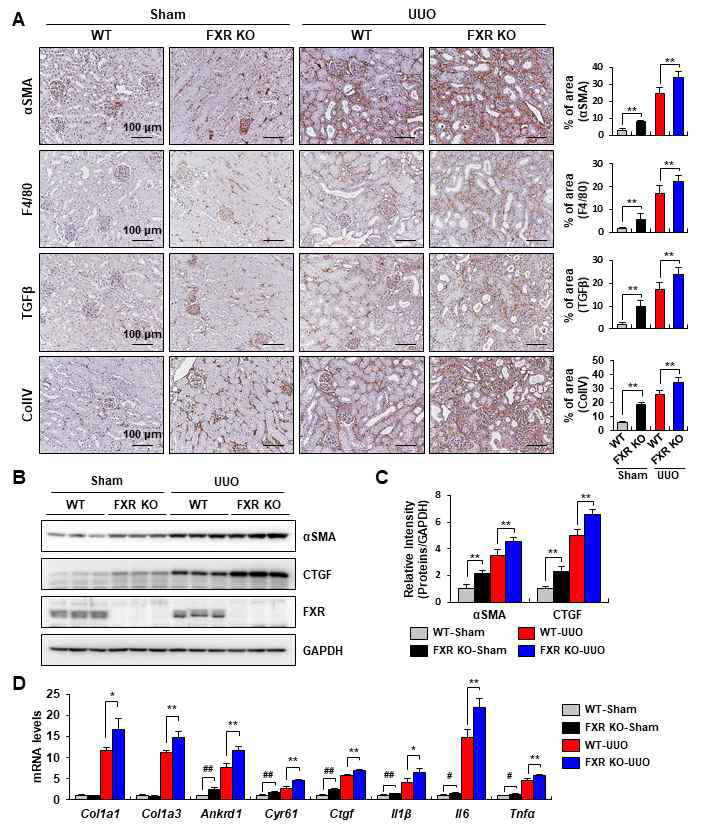 The loss of FXR increases fibrotic and YAP target gene expression in sham and UUO models. The left ureter of male wild-type(WT) and FXR knockout (FXR KO) mice was ligated for 7 days. Mice were euthanized 7 days after sham surgery (n=8) or UUO (n=8). (A) Paraffin–embedded kidney tissue sections from sham or UUO mice were stained with αSMA, F4/80, TGFβ, and ColIV antibodies (scale bar 100 μm). Computer-based morphometric analysis of kidney fibrosis in the UUO model (Right bar graph, n =10 in each group). (B) Protein levels of αSMA, CTGF, and FXR were detected by immunoblot. (C) Relative protein levels were shown. The values for WT-Sham group are set to 1. (D) The mRNA levels of indicated genes were measured by qRT-PCR. All values are presented as mean ± SD. (n =8 in each group). Statistical significance was measured using the one-way ANOVA with the Fisher least significant difference post-test. *P<0.05, **P<0.005 and NS, statistically not significant