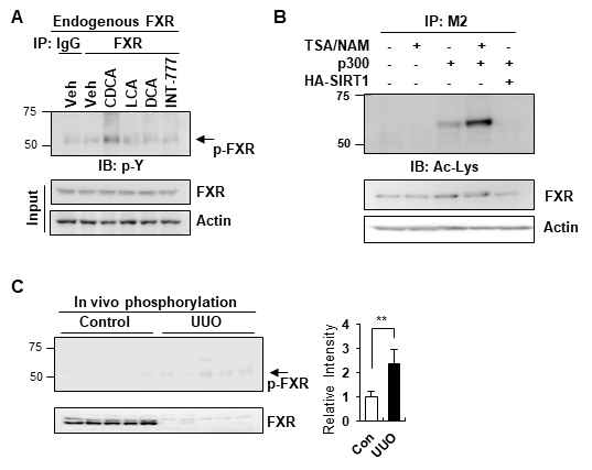 Post-translational modifications of FXR in cells and UUO mice models. (A) Effects of bile acids on endogenous FXR phosphorylation. (B) Acetylatio of FXR in HK2 cells. (C) Phosphorylation of FXR in control and UUO mice models