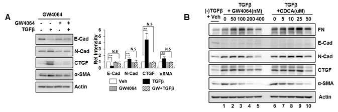 FXR activation suppresses fibrosis in HK2 cells. (A) HK2 cells were exposed to TGFbeta or GW4064. Expression of fibrotic markers (fibronectin, E-Cadherin, N-Cadherin, CTGF, and alpha-SMA) was analyzed by western blotting. (B) HK2 cells were exposed to TGFbeta and FXR agonists dose-dependent manner (GW4064 and CDCA). Expression of fibrotic markers was analyzed by western blotting