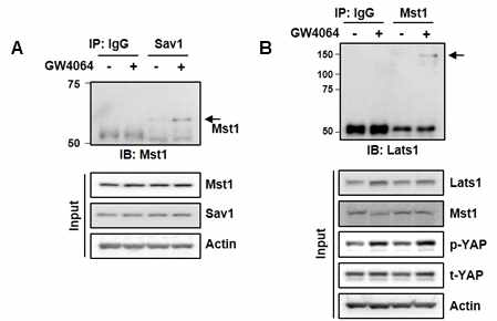 FXR agonist GW4064 increased an interaction of YAP upstream signal proteins. Vehicle or GW4064 was treated with HK2 cells. CoIP: (A) Sav1 was immunoprecipitated with Sav1 antibody, and Mst1 in the immunoprecipitation was detected by Mst1 antibody. (B) Mst1 was immunoprecipitated with Mst1 antibody, and Lats1 in the immunoprecipitation was detected by Lats1 antibody