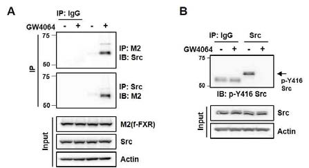 FXR agonist GW4064 treatment activates Hippo pathway. (A) HK2 cells were transfected with flag-FXR expression plasmid, and then, the cells were treated with 200 nM GW4064 for 30 min. Flag-FXR interaction with Src was detected by Co-IP/IB (B) Cells were treated with GW4064 (200 nM) for 30 min, and p-Src levels were determined by immunoprecipitation/immunoblot