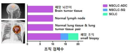 2차년도 폐암 샘플 모집 현황