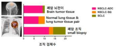 1차년도 폐암 샘플 모집 현황