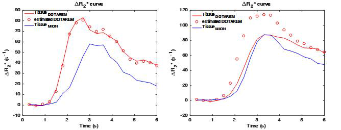 정상 조직에서 MION의 DSC-MRI 커브를 이용하여 DOTAREM 커브를 예측한 결과 (왼쪽 그림). 병변 지역에서 결과 (오른쪽 그림). 예측한 데이터(빨간색 동그리미)와 실제 데이터 (빨간색 실선)가 BBB의 손상에의해서 차이가 생김