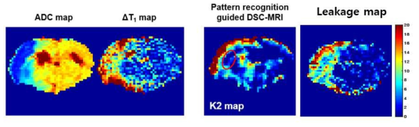 병변지역과 BBB 손상지역 영상화 맵 (ADC map, ΔT1 map). MION을 이용하여 DOTAREM 유추하는 방식이 기존의 BBB 손상도 맵보다 더 민감함을 보임 (K2 map, 빨간 동그라미)