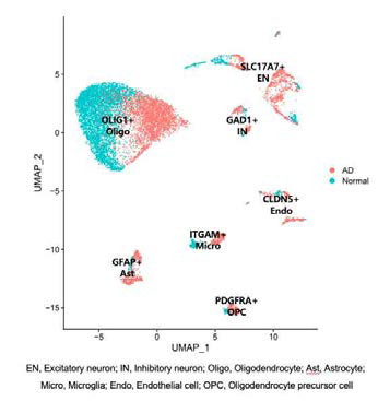 단일세포 전사체 분석을 통한 알츠하이머병 환자 특이적 유전자 발현 변화를 보이는 세포 분석