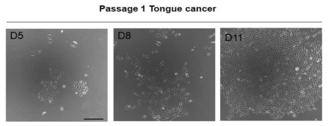 분리된 설암 상피세포의 증식 시 세포 morphology (scale bar = 100μm)