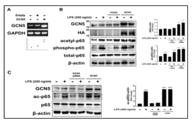 GCN5 regulates Lysine residue 310 in the RelA protein