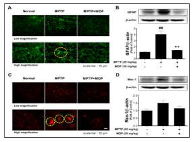 MOP attenuated MPTP neurotoxicity-induced microglial activation in mouse model of PD