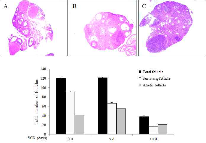 A Comparison of the total number of follicles, survival follicles, and atretic follicles from VCD-injected mice. Representative section of 8 weeks mouse (A), VCDinjected 5 days (B), VCD- injected 10 days (C) ovary stained by HE