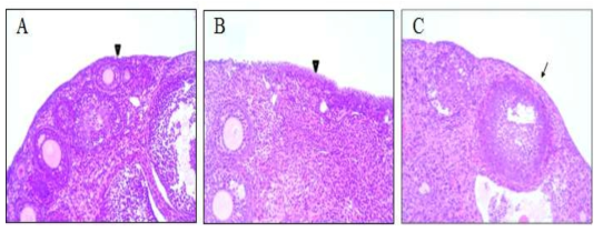 A comparative histo-architecture of mouse ovarian surface epithelium (OSE) in the 8 weeks mouse (A), VCD- injected 5 days (B), VCD- injected 10 days (C) group