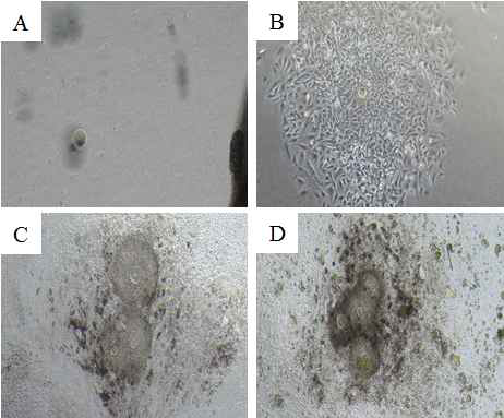 어린 마우스(2개월)의 scraped-OSE의 체외 배양 후 세포의 형태적 변화 관찰 (A) 체외배양 1일후, (B) 대조군 0 mM (C) NaC 10mM, (D) NaC 100mM