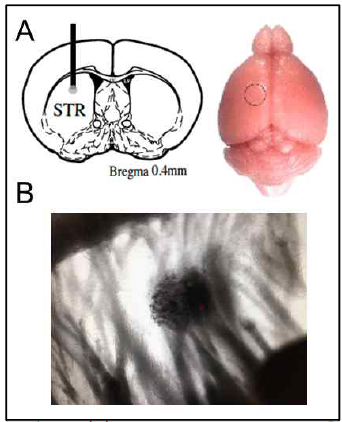 (A) Stereotaxic injection을 통해 α-syn PFF를 dorsal striatum(등쪽 선조체) 영역에 주입함. (B) α-syn PFF 주입 2개월 후 선조체 뇌절편에서의 IR-DIC 이미지. α-syn PFF 주입 위치를 확인할 수 있음