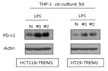 THP-1 세포주와 coculture한 후 TREM1 과발현 세포주에서의 단백발현 변화