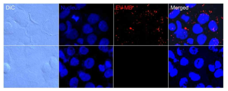 MIA-PaCa-2 유래 EVs를 융합한 마이크로 버블의 모세포에 대한 표적능. EV-MBs (위)와 일반 마이크로버블 (아래)