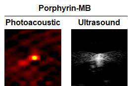 Porphyrin 마이크로 버블의 광음향 및 초음파 조영능