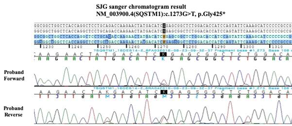 원인 유전자 SQSTM1을 규명한 골이형성증 가계의 Sanger sequencing 결과