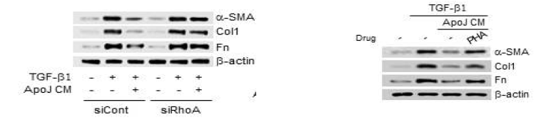 RhoA siRNA 또는 HGF 수용체 억제제는 조건화된 배양액에 의한 근섬유모세포 표현형 억제 효과를 제거함