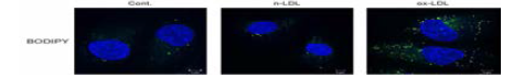 신장상피세포에서 ox-LDL 자극 실험 : 신장상피세포주(HK-2)에서 ox-LDL 처리후 세포 내 지질 축적이 증가함