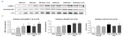 Lipid droplet 분획에서 autophagosome 단백질들의 발현을 증명함