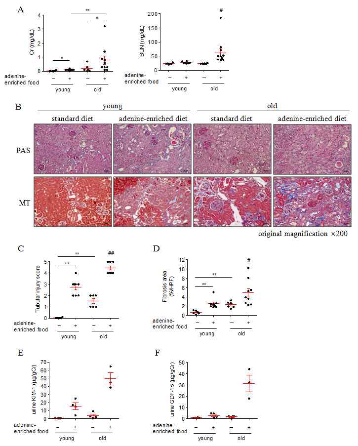 노화가 아데닌 유도 신섬유화에 미치는 영향 : serum Cr, BUN, histology, injury markers : 노화는 아데닌 모델에서 신손상 및 신장 섬유화를 의미있게 증가시킴