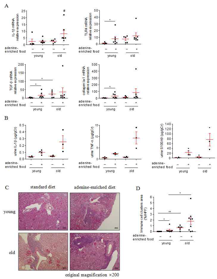 노화가 아데닌 유도 신섬유화에 미치는 영향 : 염증 표지자, 신장내 면역세포 clusters (TLT)