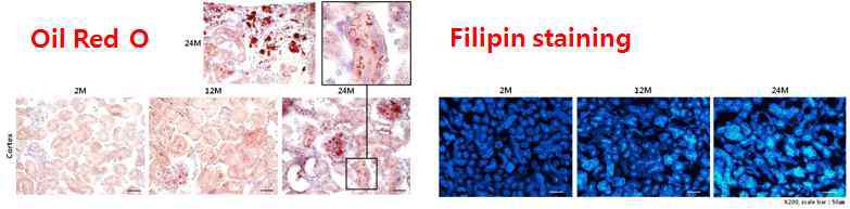 노화에 따른 신장내 지질 축적의 증가를 IHC으로 확인함
