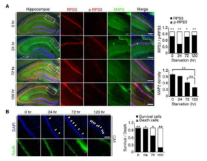 Akt-dependent phosphorylation of RPS3 is critical for protecting neuronal death under starvation