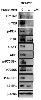 광범위 큰 B 세포 림프종 GCB 타입의 세포주인 OCI-LY7에서 PD-0332991에 의한 Survival pathway에 기여하는 여러 가지 세포내 신호전달 분자의 활성 평가도