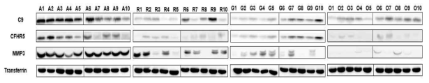 Verification of C9, CFHR5, and MMP3 in synovial fluid by western blot. Western blot analysis in the original synovial fluid sample set: A; AS (n=10), R; RA (n=10), G; gout (n=10), and O; OA (n=10)