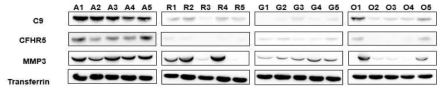 In the Independent sample {AS (n=5), RA (n=5), Gout (n=5), OA(n=5) }, validation of C9, CFHR5, MMP3 was performed. These 3 proteins(C9, CFHR5, MMP3) were overexpressed in AS as in the Identical sample (A-AS, R-RA, G-Gout, O-OA)