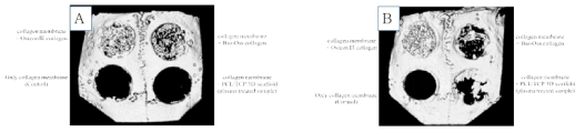 토끼 두개골 결손부 모델에서의 플라즈마 처리된 200㎛ filament로 제작된 3D scaffold의 골조직 재생 효과의 Micro-CT 결과(2주후(A) Vs. 6주후(B))