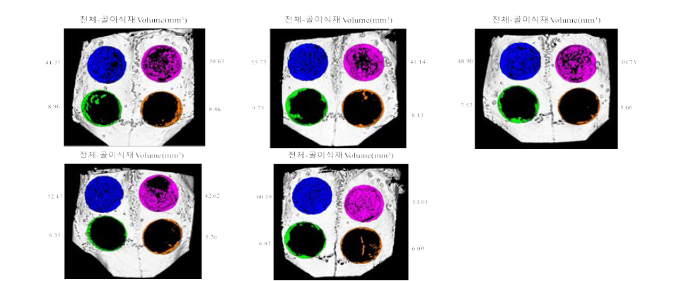 토끼 두개골 결손부 모델에서의 플라즈마 처리된 200㎛ filament로 제작된 3D scaffold의 골조직 재생 효과의 Micro-CT 결과(2주)