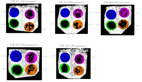 토끼 두개골 결손부 모델에서의 플라즈마 처리된 200㎛ filament로 제작된 3D scaffold의 골조직 재생 효과의 Micro-CT 결과(6주)