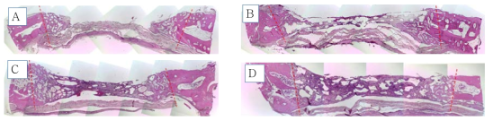 토끼 두개골 결손부 모델에서의 플라즈마 처리된 200㎛ filament로 제작된 3D scaffold의 골조직 재생 효과의 조직학적 검사 결과(6주) A: control, B: 200㎛ filament로 제작된 3D scaffold, C: Bio-oss collagen , D: Osteon III collagen