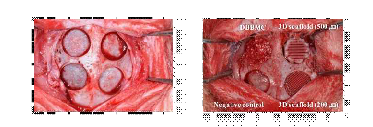 토끼 두개골 결손부 모델에서의 플라즈마 처리된 200㎛ filament와 500㎛ filament 로 제작된 3D scaffold의 골조직 재생 효과의 비교실험