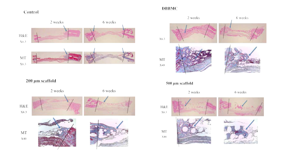 토끼 두개골 결손부 모델에서의 플라즈마 처리된 200㎛ filament와 500㎛ filament로 제작된 3D scaffold의 골조직 재생 효과의 조직학적 검사 결과(2주 & 6주)