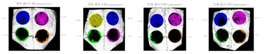 토끼 두개골 결손부 모델에서의 플라즈마 처리되지 않은 200㎛ filament로 제작된 3D scaffold의 골조직 재생 효과의 Micro-CT 결과(2주)