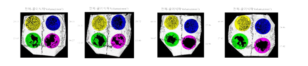 토끼 두개골 결손부 모델에서의 플라즈마 처리되지 않은 200㎛ filament로 제작된 3D scaffold의 골조직 재생 효과의 Micro-CT 결과(6주)