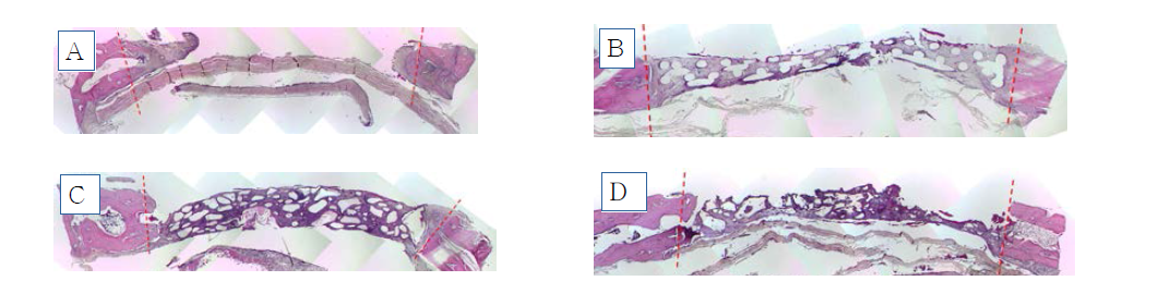 토끼 두개골 결손부 모델에서의 플라즈마 처리되지 않은 200㎛ filament로 제작된 3D scaffold의 골조직 재생 효과의 조직학적 검사 결과(2주) A: control, B: 200㎛ filament로 제작된 3D scaffold, C: Bio-oss collagen , D: Osteon III collagen