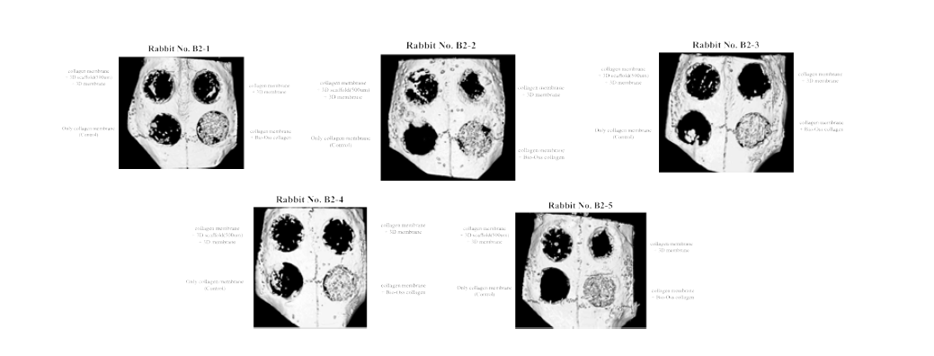 토끼 두개골 결손부 모델에서의 플라즈마 처리된 200㎛ filament membrane와 500㎛ filament로 제작된 3D scaffold의 골조직 재생 효과의 Micro-CT 결과(2주)