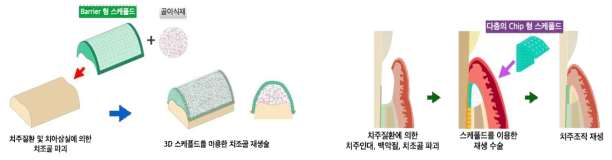 3D 프린터 기술을 이용한 효과적인 scaffold의 개발(A. 치조골 재생을 위한 scaffold의 개발, B.치주조직 재생을 위한 scaffold의 개발 )