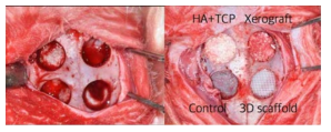 토끼 두개골 결손부 모델에서의 플라즈마 처리된 200㎛ filament로 제작된 3D scaffold의 골조직 재생 효과의 비교실험